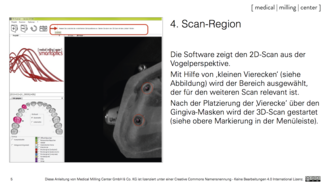 4. Scan-Region