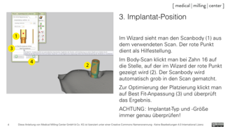 3. Implantat-Position
