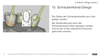 15. Schraubenkanal Design