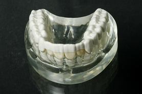 Promysan Dental-Schiene